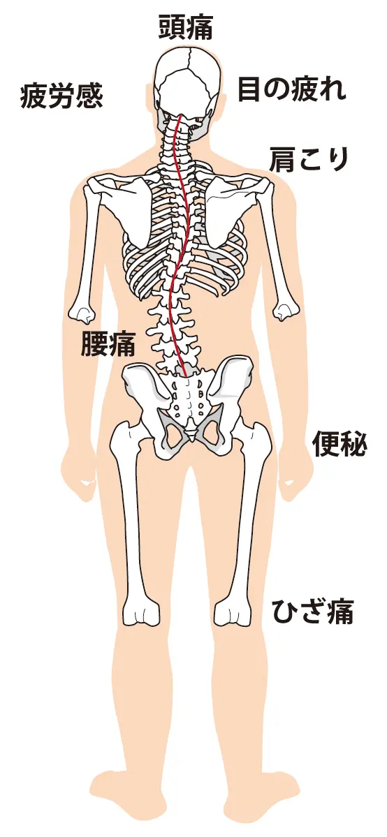 背骨の歪みによる症状