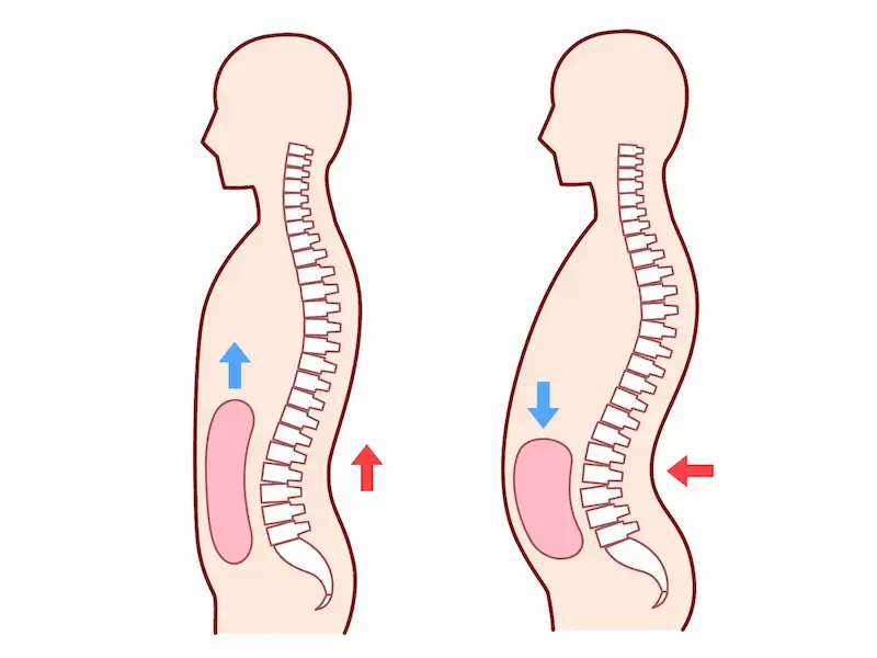 良い姿勢と悪い姿勢での内臓への影響